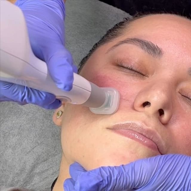 Skin Brightening & Glow Program (8) at Haus of Glam by Karina J in Haverhill, FL