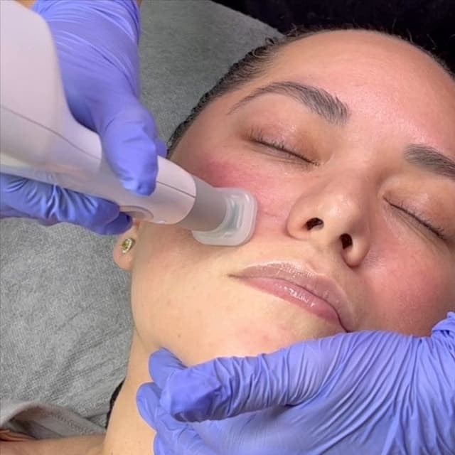 Skin Brightening & Glow Program (5) at Haus of Glam by Karina J in Haverhill, FL